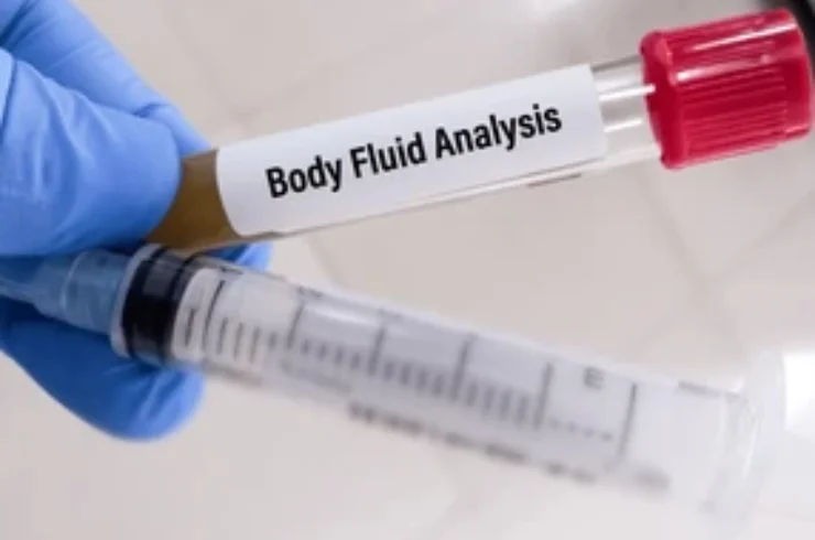 Body Fluid Analysis