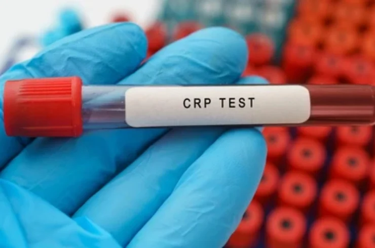 C-Reactive Protein (CRP)