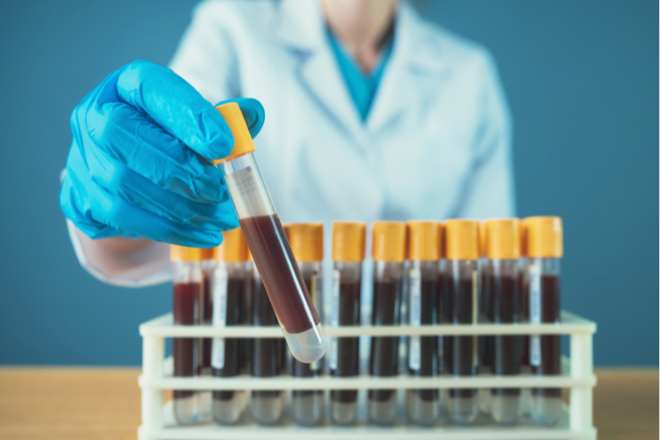 Coagulation Profile (PT, INR, APTT, D-Dimer)