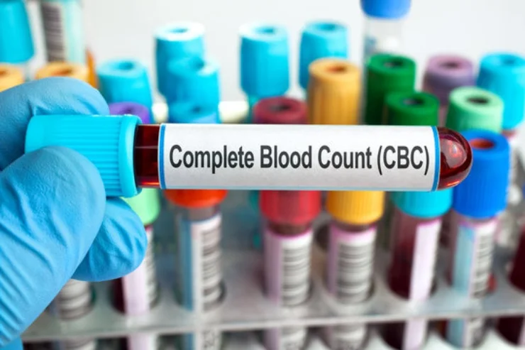 Complete Blood Count (CBC)