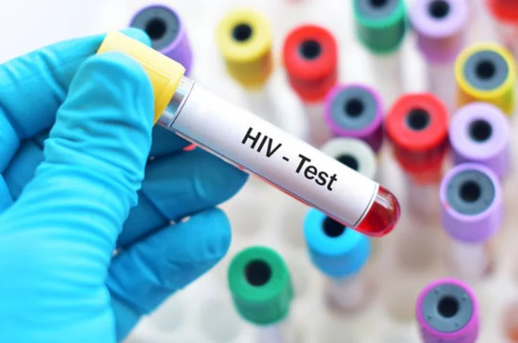 HIV, HBsAg, HCV Testing