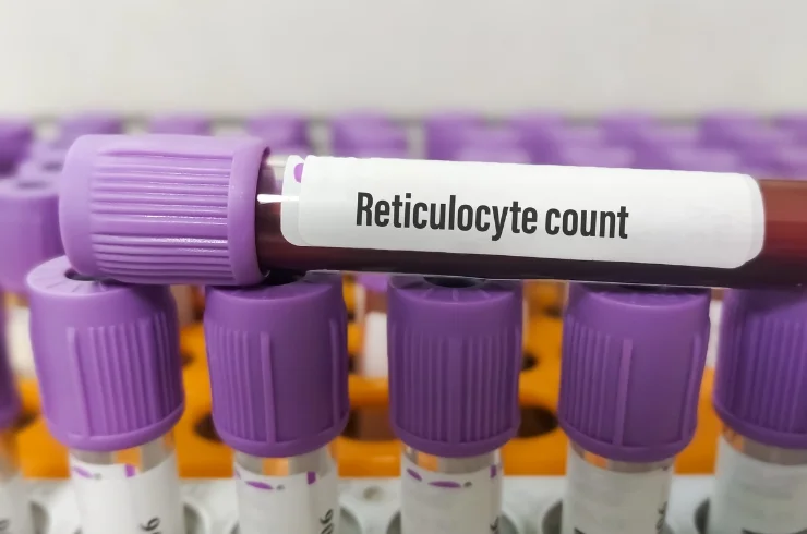 Reticulocyte Count