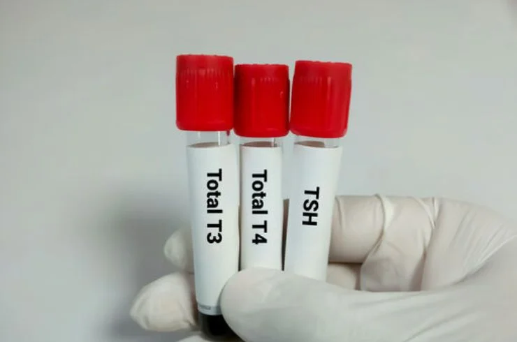 Thyroid & Hormonal Assays (TSH, T3, T4)