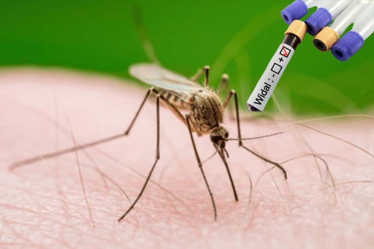 Dengue, Malaria, and Chikungunya Tests