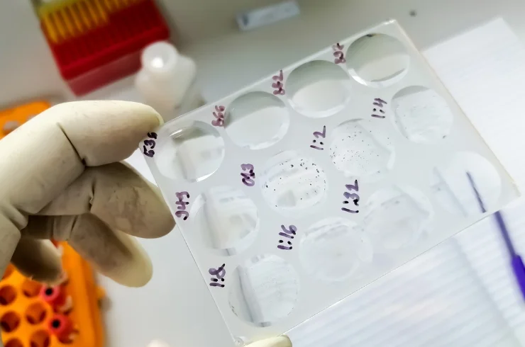 VDRL (Syphilis Test)